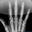 X��ɨ����(X-Ray Scanner for Android)