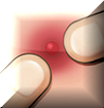 ������Pimple Popper