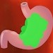 ��ƨ��ԮFart Relief