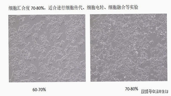 Cell Survivor 细胞类型选择界面