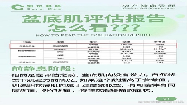 G动 盆底肌 用户评价