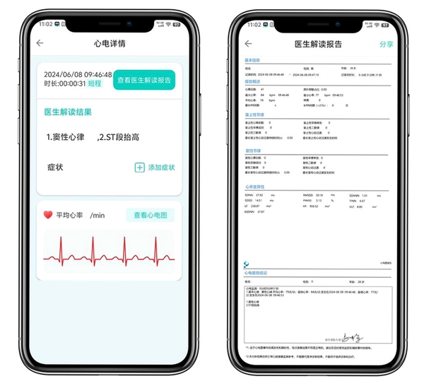 心出运行截图