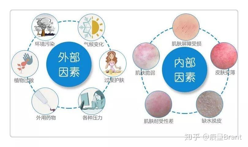 知悦敏感肌修护总结与护肤建议