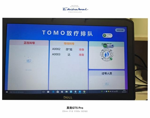 Tomo运行截图